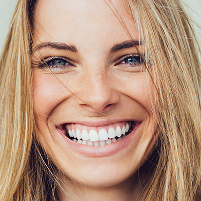 Dental veneers fairfax va