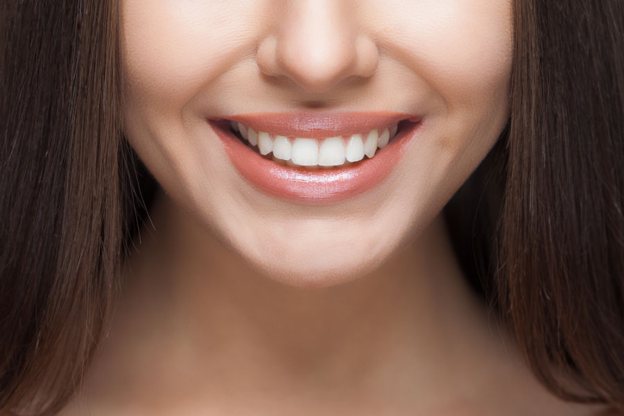 young woman smiling teeth whitening fairfax va